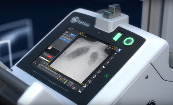 Rynek czujników rentgenowskich napędzają aplikacje medyczne i przemysłowe 