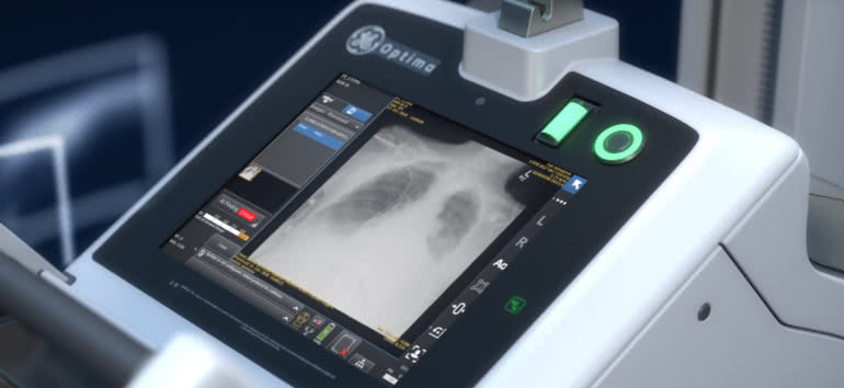 Rynek czujników rentgenowskich napędzają aplikacje medyczne i przemysłowe 